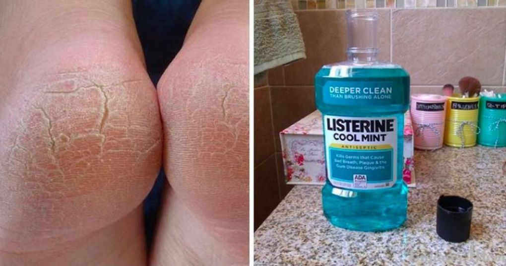 Удивительные способы использование Listerine, о которых должна знать каждая женщина